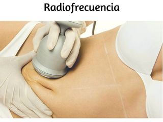 Radiofrencuencia