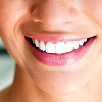 Mitos e verdades sobre prótese dentária