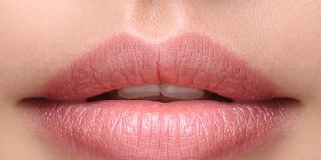 Aumento de lábios: como conseguir resultados naturais