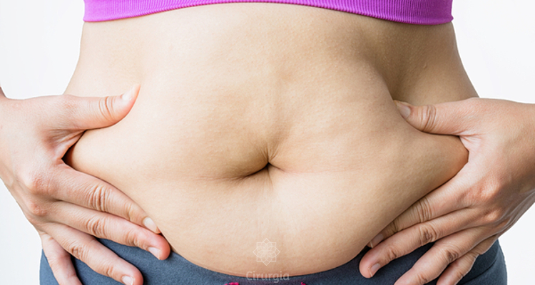 Tipos de abdominoplastia: qual é o mais adequada para cada caso?