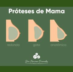 Prótesis mamaria - Dra. Mariana Fernandes