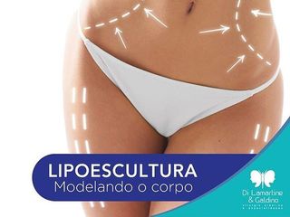 Lipoescultura