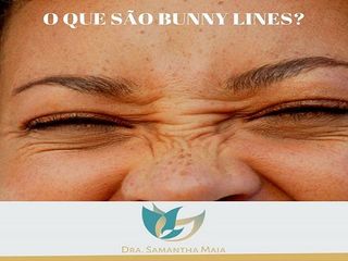 Bunny lines