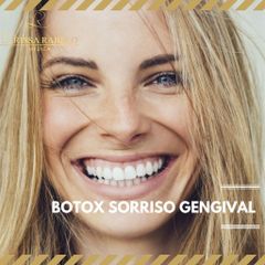 Botox na gengiva