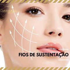 Fios de sustentação