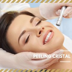 Peeling de cristal