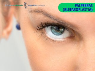 Blefaroplastia