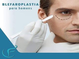 Blefaroplastia - Dr. Franklin Carneiro