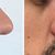 Rinoplastia nariz masculino grande ponta bulbosa