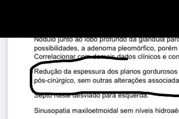 Exame de ressonância magnética com laudos diferentes - 32840