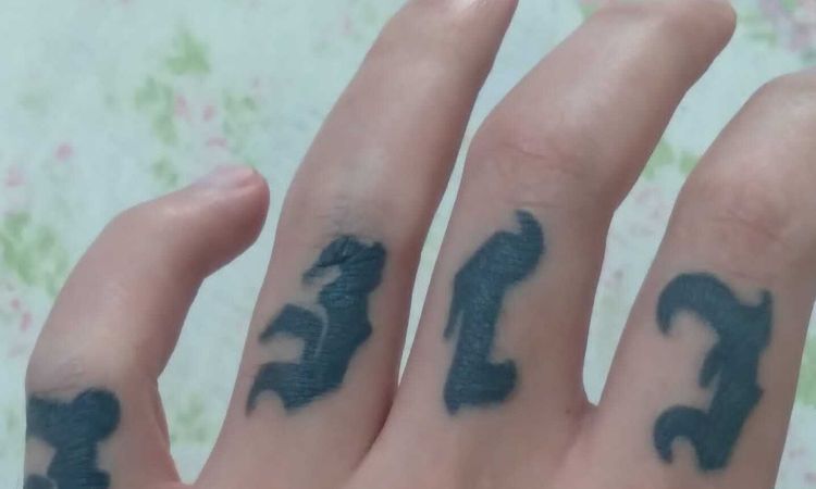 Remoção de tatuagem nos dedos com cirugia - 60187