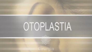 Otoplastia