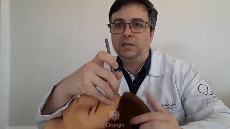 Angulação correta na implantação dos fios durante o Transplante Capilar - Dr Gustavo Mello