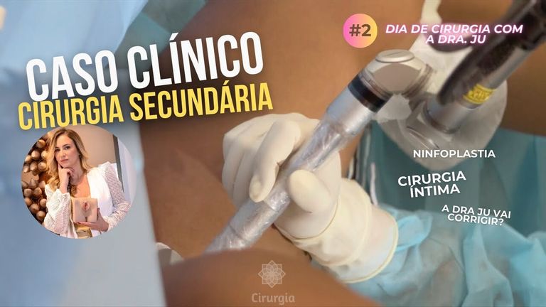 TEM COMO CORRIGIR CIRURGIA ÍNTIMA? Cirurgia Secundária – Dra. Juliana Moreira