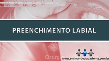 Preenchimento labial