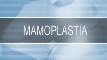 Mamoplastia