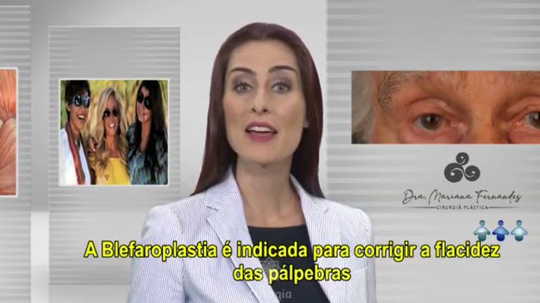 Blefaroplastia - Dra. Mariana Fernandes