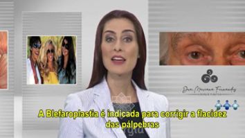 Blefaroplastia - Dra. Mariana Fernandes