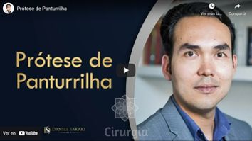 Próteses de Panturillha