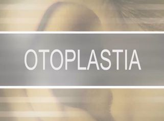 Otoplastia - Dr. Adson Andrade de Figuerêdo