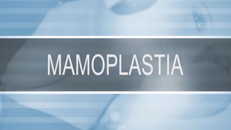 Mamoplastia - Dr. Adson Andrade de Figuerêdo
