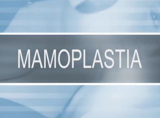 Mamoplastia - Dr. Adson Andrade de Figuerêdo