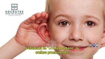 Tudo o que você precisa saber: Otoplastia!