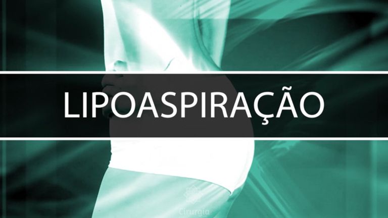 Lipoaspiraçao - Dr. Adson Andrade de Figuerêdo