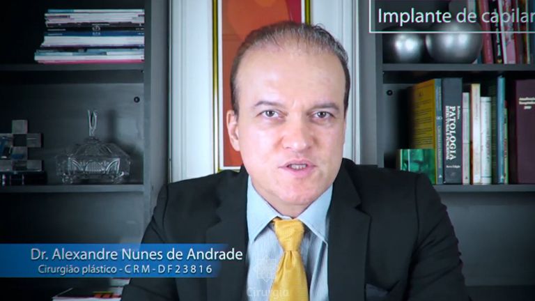 Implante capilar - Dr. Alexandre Nunes